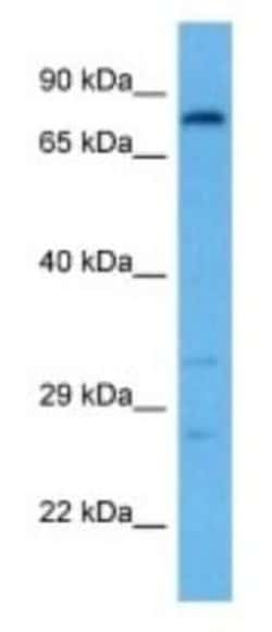 IKB zeta Rabbit anti-Mouse, Polyclonal, Novus Biologicals 100 &mu;g; Unconjugated:Antibodies,